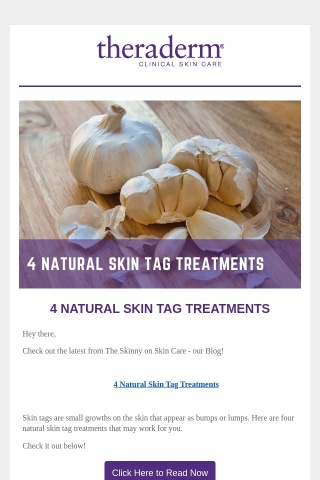 Looking for Natural Treatments for Skin Tags?