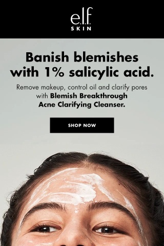 We zit you not, salicylic acid works.